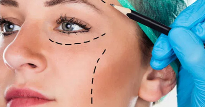 Plastic Surgery