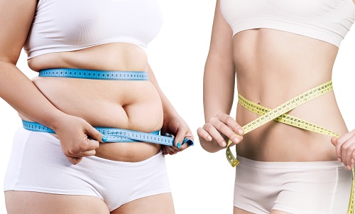 About Otoplasty