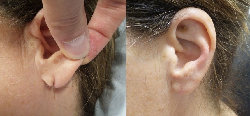 About Cosmetic Surgery
