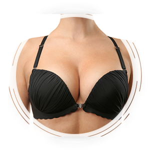 Breast Augmentation
