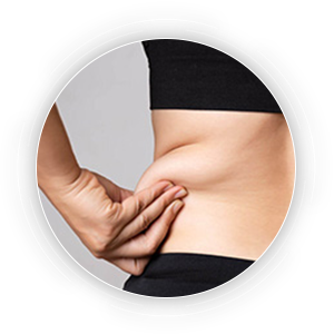 Liposuction